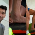 Marc Roca muestra sus heridas de ‘guerra’ en el tobillo operado